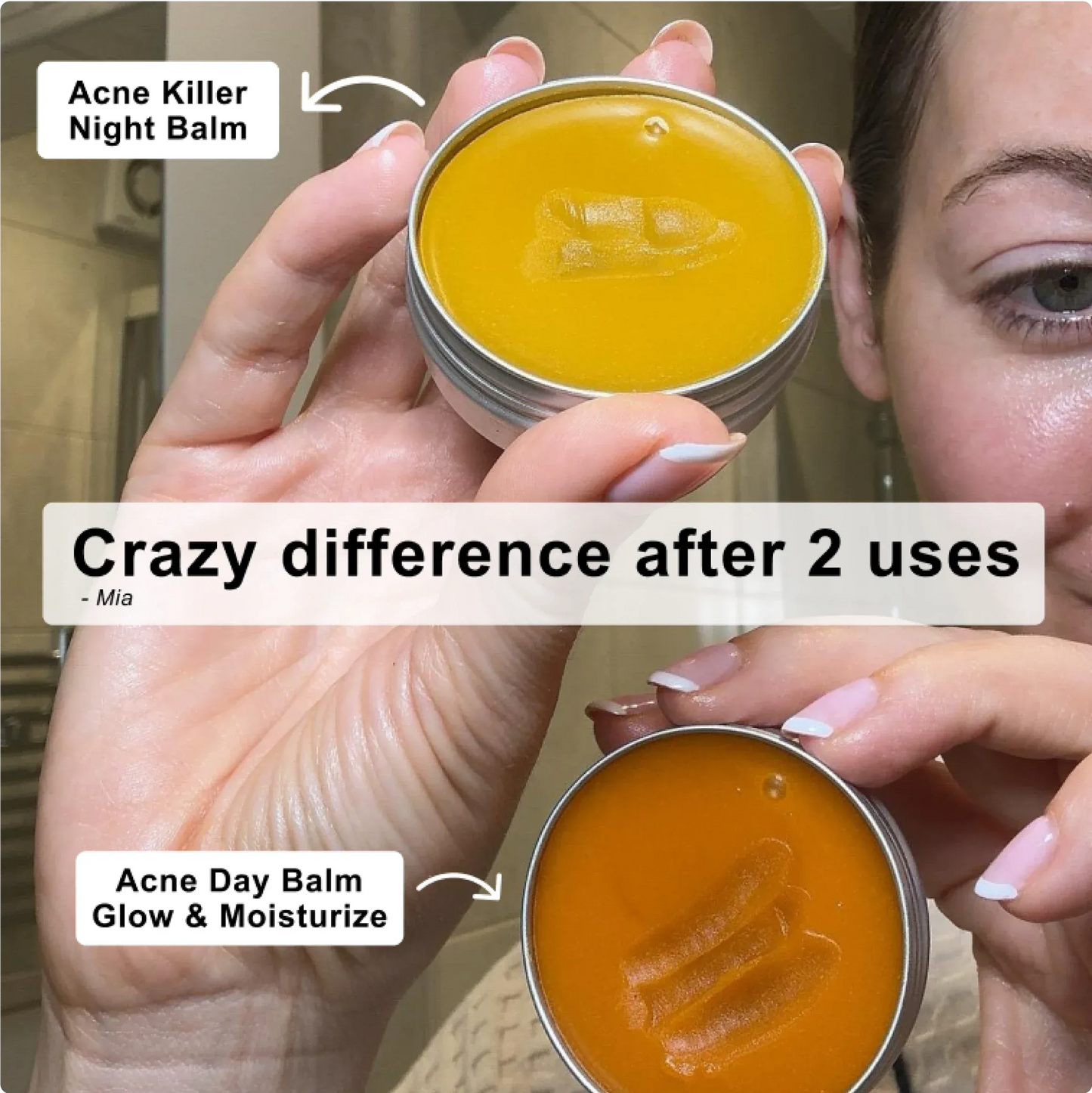 Kill Acne & Redness Ritual